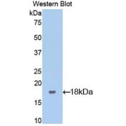 Western blot analysis of recombinant Mouse LIFR.