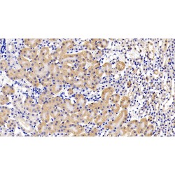 Leukemia Inhibitory Factor Receptor (LIFR) Antibody