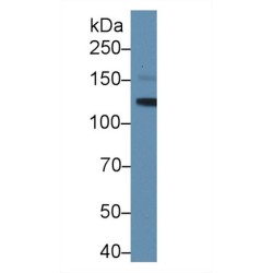 Leukemia Inhibitory Factor Receptor (LIFR) Antibody