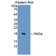 Western blot analysis of recombinant Mouse LIFR.