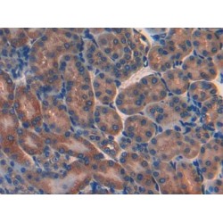 Leukemia Inhibitory Factor Receptor (LIFR) Antibody