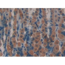 Leukemia Inhibitory Factor Receptor (LIFR) Antibody