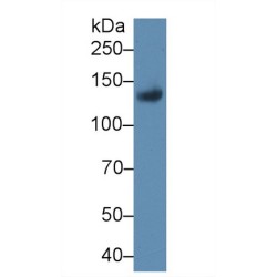 Leukemia Inhibitory Factor Receptor (LIFR) Antibody