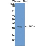 Western blot analysis of recombinant Rat LIFR.