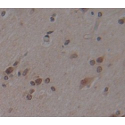 Mitogen-Activated Protein Kinase 8 / JNK1 (MAPK8) Antibody