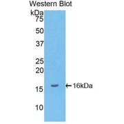 Western blot analysis of the recombinant protein.