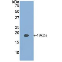 Phospholipase A2 Activating Protein (PLAA) Antibody