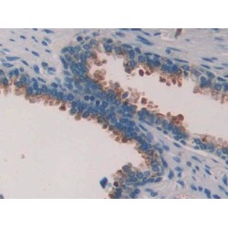 Phospholipase A2 Activating Protein (PLAA) Antibody