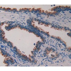 Phospholipase A2 Activating Protein (PLAA) Antibody