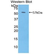 Western blot analysis of the recombinant protein.