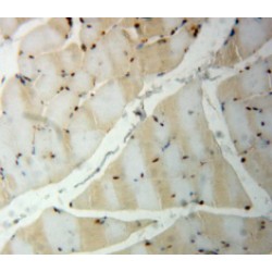 Platelet Derived Growth Factor BB (PDGFBB) Antibody