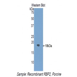 Retinol Binding Protein 2, Cellular (RBP2) Antibody