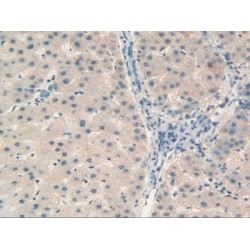 Retinol Binding Protein 5, Cellular (RBP5) Antibody