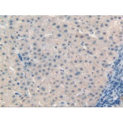 Retinol Binding Protein 5, Cellular (RBP5) Antibody