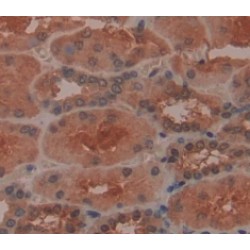 Retinol Binding Protein 5, Cellular (RBP5) Antibody