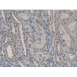 Retinol Binding Protein 5, Cellular (RBP5) Antibody