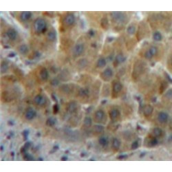 Retinol Binding Protein 5, Cellular (RBP5) Antibody