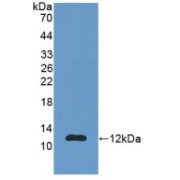 Western blot analysis of recombinant Human S100A11.