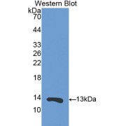 Western blot analysis of the recombinant protein.