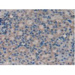 S100 Calcium Binding Protein A11 (S100A11) Antibody