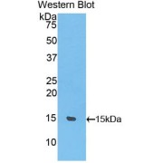 Western blot analysis of recombinant Rat UCP1 Protein.