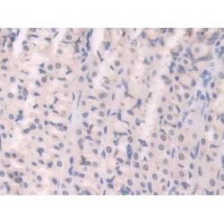 Uncoupling Protein 1, Mitochondrial (UCP1) Antibody