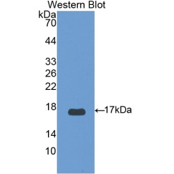 Mitochondrial Uncoupling Protein 2 (UCP2) Antibody