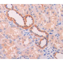 Mitochondrial Uncoupling Protein 2 (UCP2) Antibody