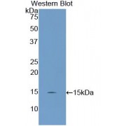 Western blot analysis of recombinant Rat UCP2.