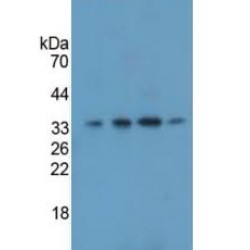 Mitochondrial Uncoupling Protein 2 (UCP2) Antibody