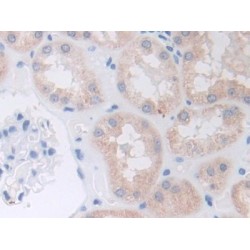 A Disintegrin And Metalloprotease 9 (ADAM9) Antibody