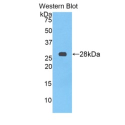 Alpha-2-Heremans Schmid Glycoprotein (AHSG) Antibody