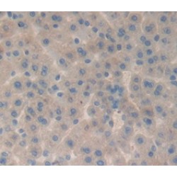 Alpha-2-Heremans Schmid Glycoprotein (AHSG) Antibody