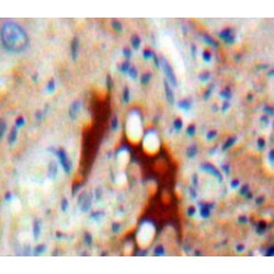 Apoptosis Signal Regulating Kinase 1 (ASK1) Antibody