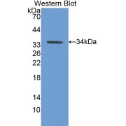 Western blot analysis of the recombinant protein.