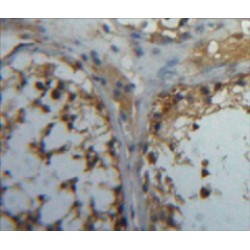 Carbonic Anhydrase VB, Mitochondrial (CA5B) Antibody