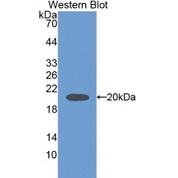 Carbonic Anhydrase VB, Mitochondrial (CA5B) Antibody