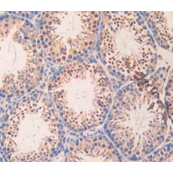 Carbonic Anhydrase VB, Mitochondrial (CA5B) Antibody