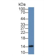 Western blot analysis of Human Liver lysate, using Mouse FABP1 Antibody (2 µg/ml) and HRP-conjugated Goat Anti-Rabbit antibody (<a href="https://www.abbexa.com/index.php?route=product/search&amp;search=abx400043" target="_blank">abx400043</a>, 0.2 µg/ml).