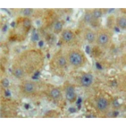 Fatty Acid Binding Protein 1, Liver (FABP1) Antibody