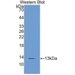 Fatty Acid Binding Protein 1, Liver (FABP1) Antibody