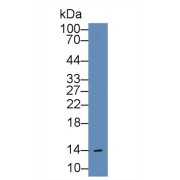 Western blot analysis of Human Liver lysate, using Rat FABP1 Antibody (2 µg/ml) and HRP-conjugated Goat Anti-Rabbit antibody (<a href="https://www.abbexa.com/index.php?route=product/search&amp;search=abx400043" target="_blank">abx400043</a>, 0.2 µg/ml).