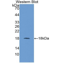 Fatty Acid Binding Protein 1, Liver (FABP1) Antibody