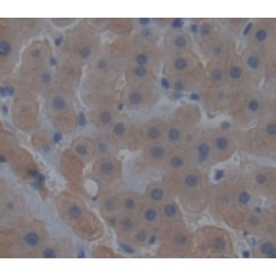 Glutamate Cysteine Ligase, Catalytic (GCLC) Antibody