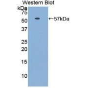 Western blot analysis of the recombinant protein.