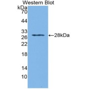 Western blot analysis of recombinant Mouse IFNa/bR1.