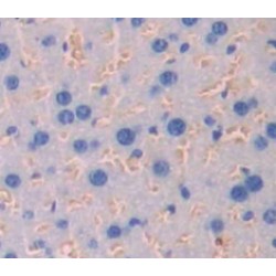 Interferon Alpha/Beta Receptor 1 (IFNa/bR1) Antibody