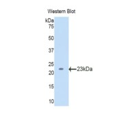 Western blot analysis of the recombinant protein.