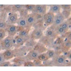 Lecithin Cholesterol Acyltransferase (LCAT) Antibody