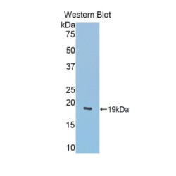 Lecithin Cholesterol Acyltransferase (LCAT) Antibody